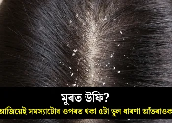 মূৰত উফি? আজিয়েই সমস্যাটোৰ ওপৰত থকা ৫টা ভুল ধাৰণা আঁতৰাওক