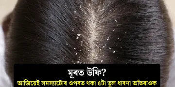 মূৰত উফি? আজিয়েই সমস্যাটোৰ ওপৰত থকা ৫টা ভুল ধাৰণা আঁতৰাওক