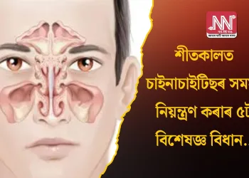 শীতকালত চাইনাচাইটিছৰ সমস্যা নিয়ন্ত্ৰণ কৰাৰ ৫টা বিশেষজ্ঞ বিধান…
