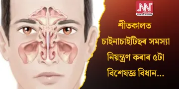 শীতকালত চাইনাচাইটিছৰ সমস্যা নিয়ন্ত্ৰণ কৰাৰ ৫টা বিশেষজ্ঞ বিধান…