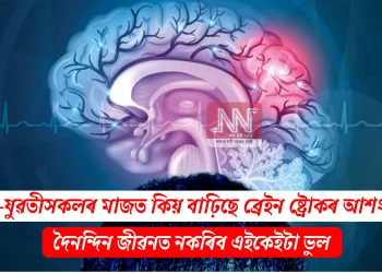 যুৱক-যুৱতীসকলৰ মাজত কিয় বাঢ়িছে ব্ৰেইন ষ্ট্ৰোকৰ আশংকা? দৈনন্দিন জীৱনত নকৰিব এইকেইটা ভুল