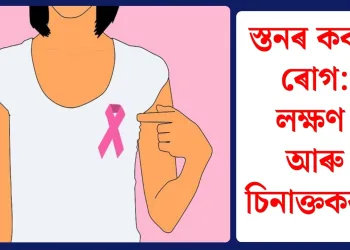 স্তনৰ কৰ্কট ৰোগ: লক্ষণ আৰু চিনাক্তকৰণ