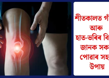 শীতকালত গাঁঠিৰ আৰু হাত-ভৰিৰ বিষ? জানক সকাহ পোৱাৰ সহজ উপায়