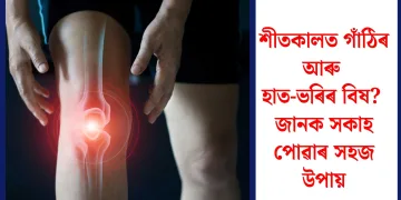 শীতকালত গাঁঠিৰ আৰু হাত-ভৰিৰ বিষ? জানক সকাহ পোৱাৰ সহজ উপায়