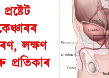 প্ৰষ্টেট কেঞ্চাৰৰ কাৰণ, লক্ষণ আৰু প্ৰতিকাৰ