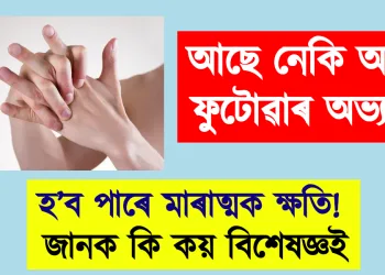 আছে নেকি আঙুলি ফুটোৱাৰ অভ্যাস! হ’ব পাৰে মাৰাত্মক ক্ষতি! জানক কি কয় বিশেষজ্ঞই
