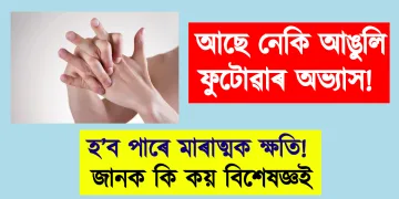 আছে নেকি আঙুলি ফুটোৱাৰ অভ্যাস! হ’ব পাৰে মাৰাত্মক ক্ষতি! জানক কি কয় বিশেষজ্ঞই