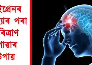 মাইগ্ৰেনৰ সমস্যাৰ পৰা পৰিত্ৰাণ পোৱাৰ উপায়