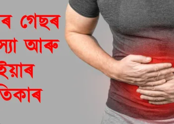 পেটৰ গেছৰ সমস্যা আৰু ইয়াৰ প্ৰতিকাৰ