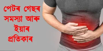 পেটৰ গেছৰ সমস্যা আৰু ইয়াৰ প্ৰতিকাৰ