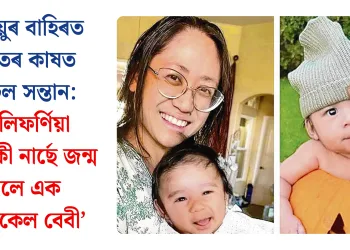 জৰায়ুৰ বাহিৰত যকৃতৰ কাষত বাঢ়িল সন্তান: কেলিফৰ্ণিয়া এগৰাকী নাৰ্ছে জন্ম দিলে এক ‘মিৰাকেল বেবী’