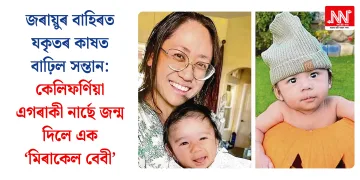 জৰায়ুৰ বাহিৰত যকৃতৰ কাষত বাঢ়িল সন্তান: কেলিফৰ্ণিয়া এগৰাকী নাৰ্ছে জন্ম দিলে এক ‘মিৰাকেল বেবী’
