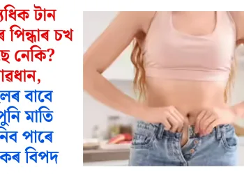 অত্যধিক টান কাপোৰ পিন্ধাৰ চখ আছে নেকি? সাৱধান, ষ্টাইলৰ বাবে আপুনি মাতি আনিব পাৰে ভয়ংকৰ বিপদ