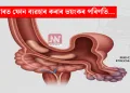শৌচাগাৰত ফোন ব্যৱহাৰ কৰাৰ ভয়ংকৰ পৰিণতি…