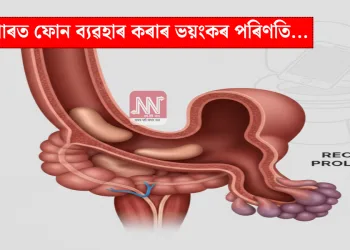 শৌচাগাৰত ফোন ব্যৱহাৰ কৰাৰ ভয়ংকৰ পৰিণতি…