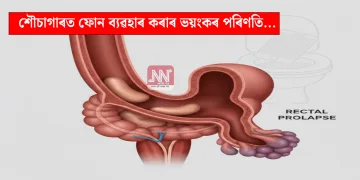 শৌচাগাৰত ফোন ব্যৱহাৰ কৰাৰ ভয়ংকৰ পৰিণতি…