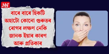 বাৰে বাৰে হিকটি অহাটো কোনো গুৰুতৰ ৰোগৰ লক্ষণ নেকি জানক ইয়াৰ কাৰণ আৰু প্ৰতিকাৰ