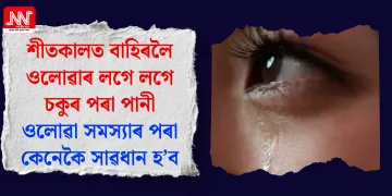 শীতকালত বাহিৰলৈ ওলোৱাৰ লগে লগে চকুৰ পৰা পানী ওলোৱা সমস্যাৰ পৰা কেনেকৈ সাৱধান হ’ব
