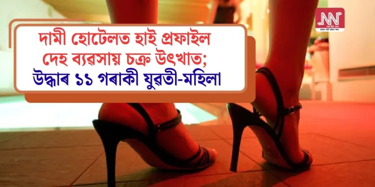 প্ৰতিনিধিত্বমূলক ফটো।