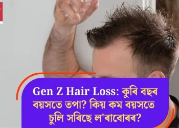 Gen Z Hair Loss: কুৰি বছৰ বয়সতে তপা? কিয় কম বয়সতে চুলি সৰিছে ল’ৰাবোৰৰ?