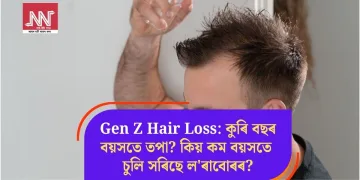 Gen Z Hair Loss: কুৰি বছৰ বয়সতে তপা? কিয় কম বয়সতে চুলি সৰিছে ল’ৰাবোৰৰ?