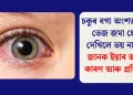 চকুৰ বগা অংশত হঠাৎ তেজ জমা হোৱা দেখিলে ভয় নাখাব, জানক ইয়াৰ আচল কাৰণ আৰু প্ৰতিকাৰ