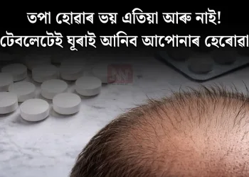 তপা হোৱাৰ ভয় এতিয়া আৰু নাই! এটা টেবলেটেই ঘূৰাই আনিব আপোনাৰ হেৰোৱা চুলি