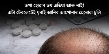 তপা হোৱাৰ ভয় এতিয়া আৰু নাই! এটা টেবলেটেই ঘূৰাই আনিব আপোনাৰ হেৰোৱা চুলি
