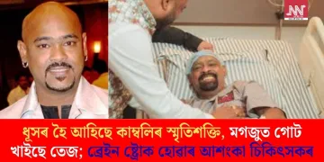 ধূসৰ হৈ আহিছে কাম্বলিৰ স্মৃতিশক্তি, মগজুত গোট খাইছে তেজ; ব্ৰেইন ষ্ট্ৰোক হোৱাৰ আশংকা চিকিৎসকৰ