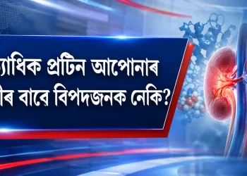 অত্যাধিক প্ৰটিন আপোনাৰ কিডনীৰ বাবে বিপদজনক নেকি? চিকিৎসকৰ ডাঙৰ সতৰ্কবাণী