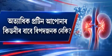 অত্যাধিক প্ৰটিন আপোনাৰ কিডনীৰ বাবে বিপদজনক নেকি? চিকিৎসকৰ ডাঙৰ সতৰ্কবাণী