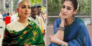 আছিল কঁকাললৈকে বৈ পৰা চুলি; কি এনেকুৱা ঘটিল যে চুলি খুৰাই টকলা হ’ল নয়নতৰা?