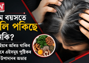 কম বয়সতে চুলি পকিছে নেকি? ইয়াৰ আঁৰত থাকিব পাৰে এইসমূহ পুষ্টিকৰ উপাদানৰ অভাৱ