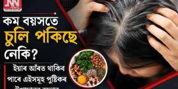 কম বয়সতে চুলি পকিছে নেকি? ইয়াৰ আঁৰত থাকিব পাৰে এইসমূহ পুষ্টিকৰ উপাদানৰ অভাৱ